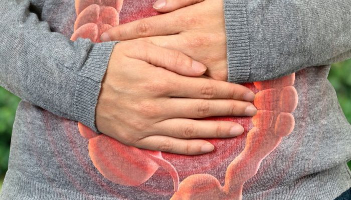 mujer sosteniendo su barriga porque le duele debido al SIBO